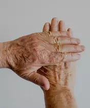 aging hands